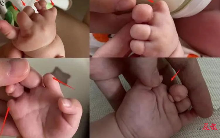 香港验血检测胎儿性别